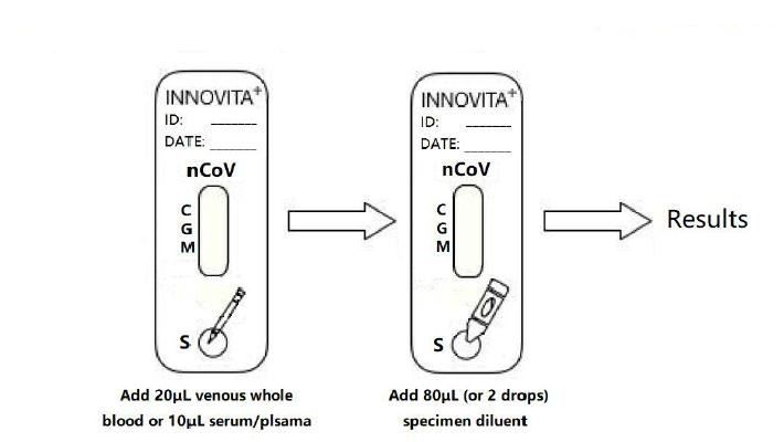 COVID-19 Antibody Diagnostic Kit